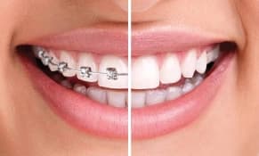 Orthodontics